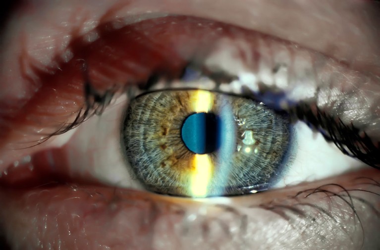 Close up view of a human eye during a slit lamp eye examination.