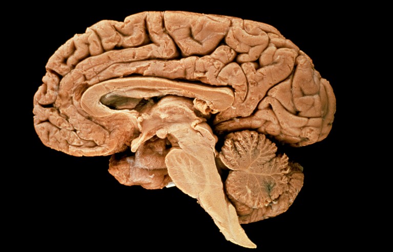 Sagittal slice through a human brain.