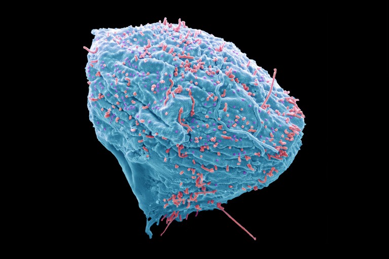 Coloured scanning electron micrography image of human cells (blue) infected with bird flu virus particles (pink).