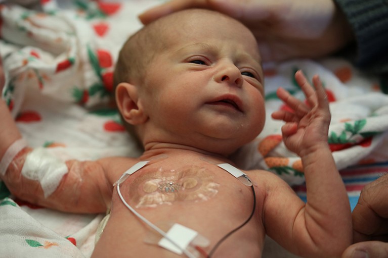 The upper torso of a small baby in a NICU cot shown with caring hands in shot and traditional wire monitors; a plaster-like clear wireless biosensor is visible on its' chest