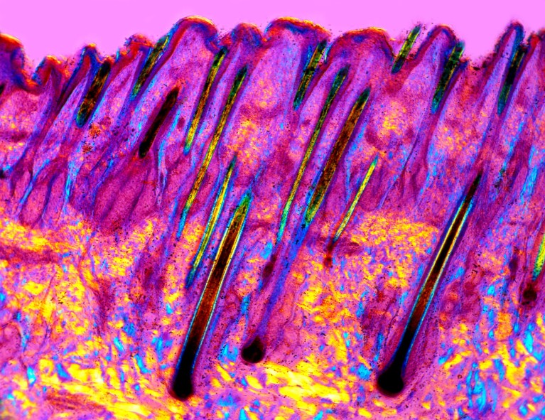 A colourful polarised light micrograph of cross section of human skin showing hair growing our of follicles