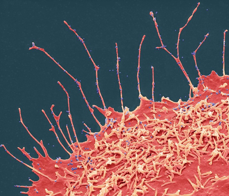 SEM teñido del brote de la variante delta del SARS-CoV-2 (puntos azules) de una célula epitelial de riñón de mamífero 24 h después de la infección.