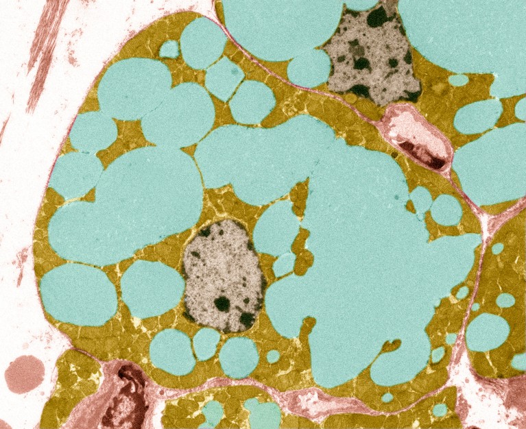 Micrografia elettronica a trasmissione colorata di una sezione del tessuto adiposo, mostrata nei colori blu e giallo