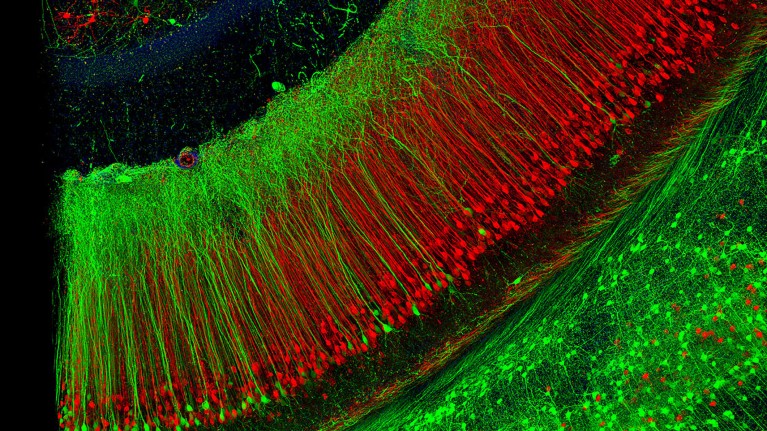 Fluorescent light micrograph of neuronal (nerve cell) fibres in the hippocampus of the brain of a mouse.