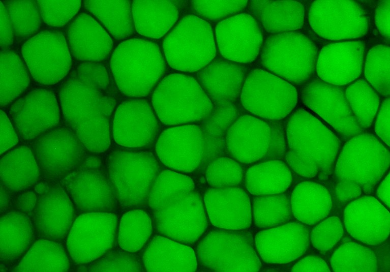 Fat-filled cells, stained bright green