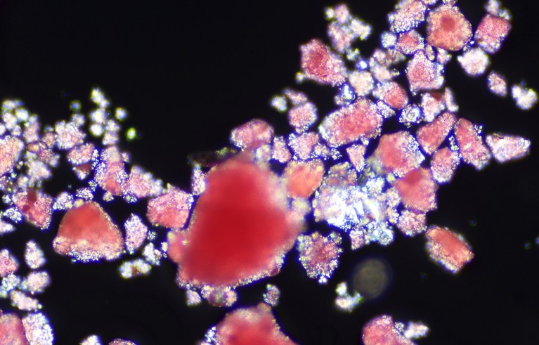 A light micrograph of microplastic particles in a drop of seawater.