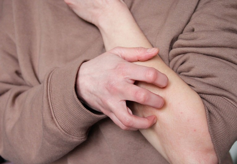 A close-up of a woman wearing a taupe coloured jumper, scratching her forearm