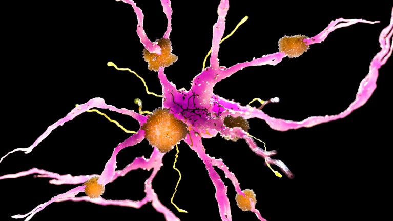 Illustration of amyloid plaques (orange) on a nerve cell (pink), on a black background