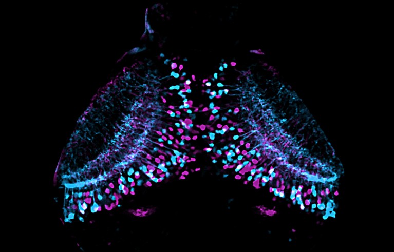 Confocal microscopy image of neurons in the optic tectum of the brain of a zebrafish larva