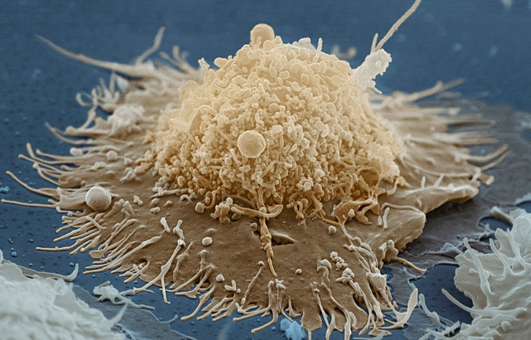 Coloured scanning electron micrograph of a B lymphocyte.