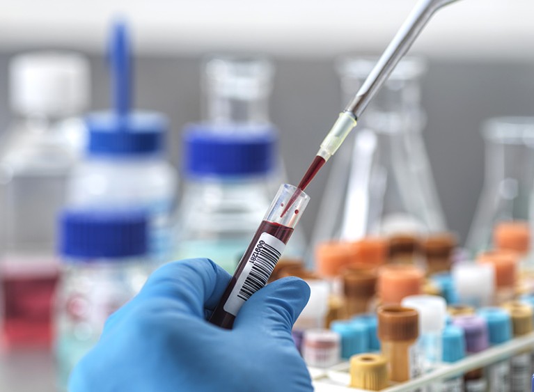 Close-up of blue-gloved hand holding a vial of blood and extracting a sample using a long pipette.