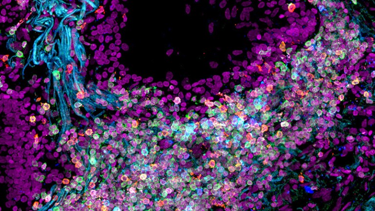 Human lung cells mapped by the Human Cell Atlas