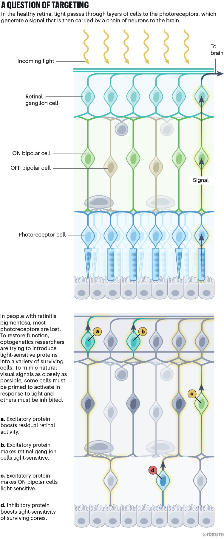 An infographic showing the differences in how light passes through layers of cells to the photoreceptors in a healthy retina, and in people with retinitis pigmentosa, and how to restore it.