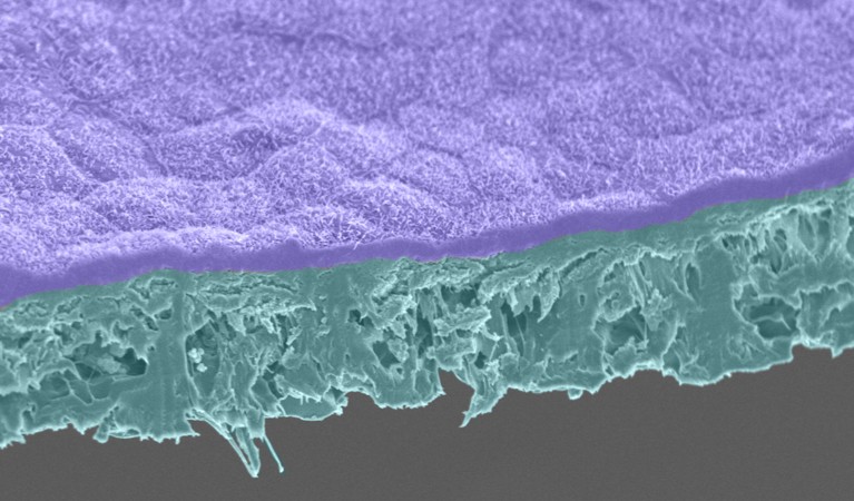 A coloured Scanning Electron Micrograph of a thin layer of purple cells laying atop a thicker cyan coloured biodegradable scaffold on a grey background