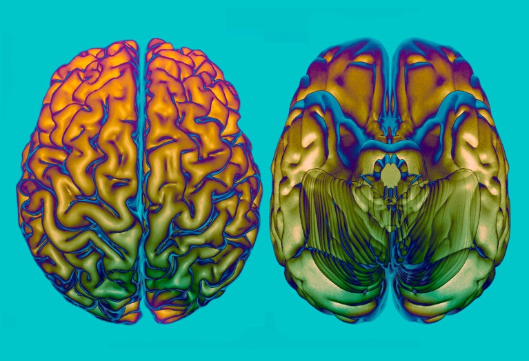 Coloured 3D MRI scans of a human brain, seen from above (left) and below (right).