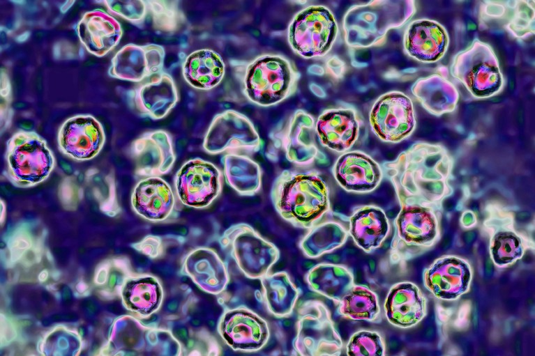 A microscopy photograph of the measles virus, showing circular blobs in purple, green and pink colours