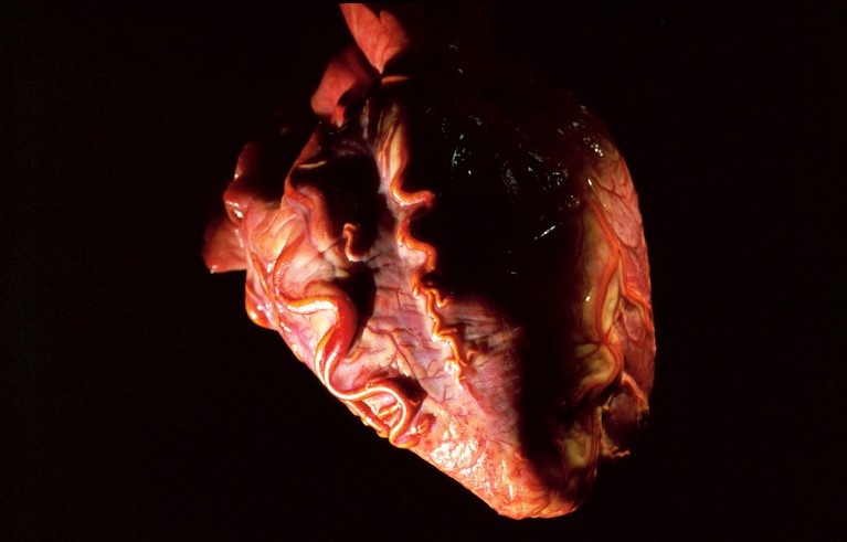 Specimen of an adult human's heart isolated on a black background.