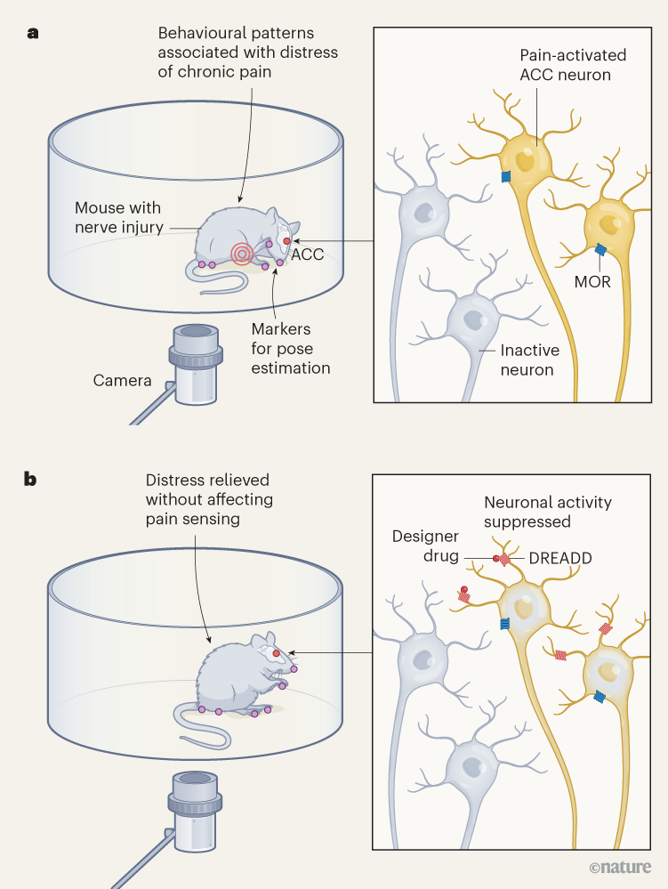 Chronic pain could be eased by uncoupling the sensory and emotional ...