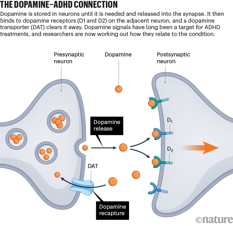 The dopamine–ADHD connection: infographic illustrating the interaction of dopamine in neurons and how they relate to ADHD condition.