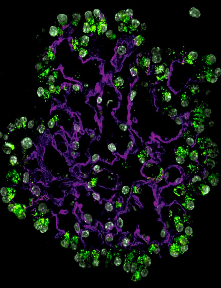 Green blobs around purple, string-like structures.