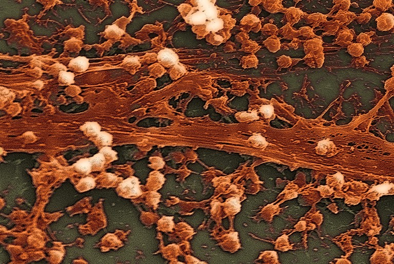 A scanning electron microscope image depicting large numbers of Staphylococcus aureus bacteria.