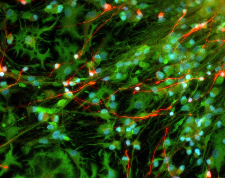 Fluorescence light micrograph of neurons (nerve cells) from a human foetus that resemble a close up of shrubbery.