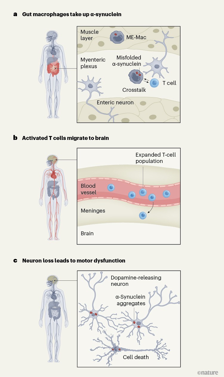 Immune cells from the gut drive development of Parkinson’s disease in ...