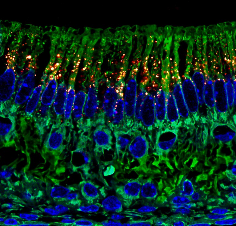 Microscope image of Ameloblasts, green and blue features. They produce matrices that eventually become “enamel”, the hardest tissue in animal/human close to Diamond.