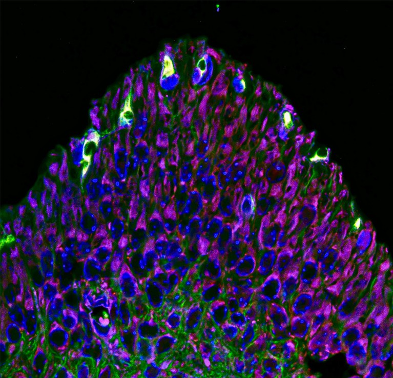 Microscope image of Ameloblasts, purple and blue features. They produce matrices that eventually become “enamel”, the hardest tissue in animal/human close to Diamond.