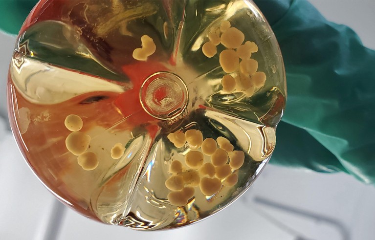A glass flask containing spheroid tissue structures, seen from below.