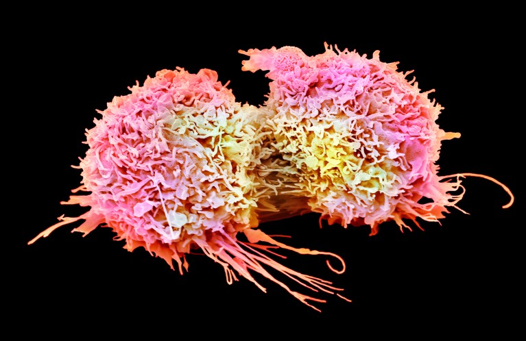 Coloured scanning electron micrograph of rounded pink and yellow dividing lung cancer cells from an adenocarcinoma on a black background