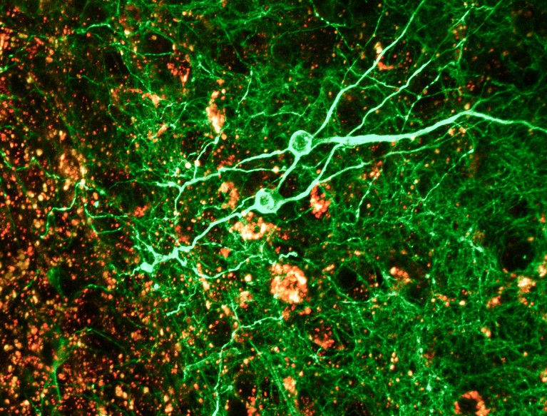 Confocal light micrograph of a section through brain tissue, in green, yellow and black.