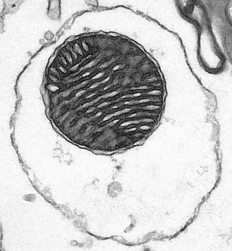 Black and white electron microscope image of a mitochondrion with dense, folded internal membranes, surrounded by a lighter outer region