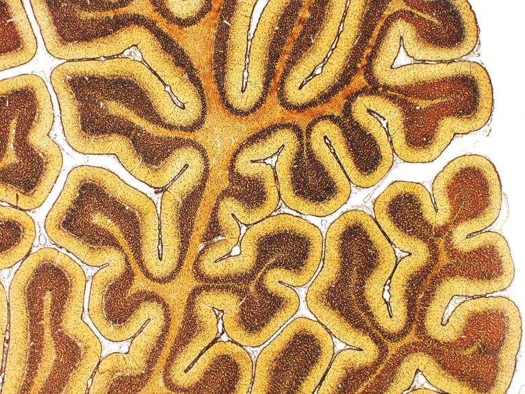 A light micrograph of a cerebellum cross‑section showing tightly folded, branching layers in yellow and brown colours