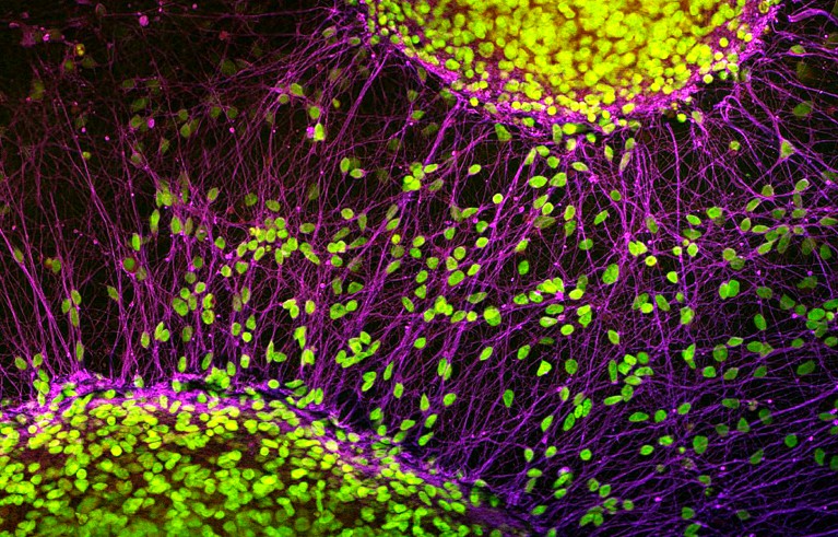 Fluorescence light micrograph of nerve cells derived from induced pluripotent stem cells