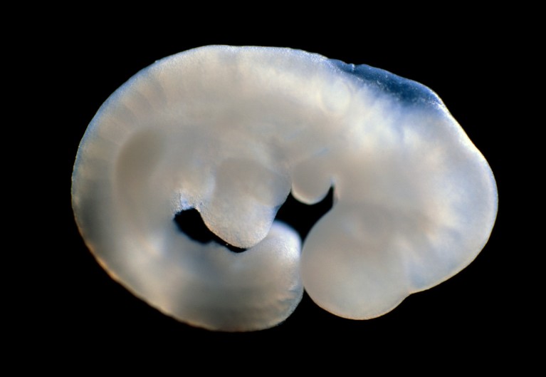 Light micrograph of a 9.5 day old mouse embryo.