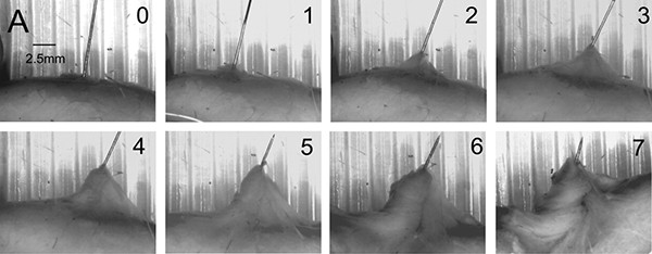A series of sequential images of a close-up view of flesh under a dissecting microscope showing the formation of a connective tissue ‘whorl’ with needle rotation.
