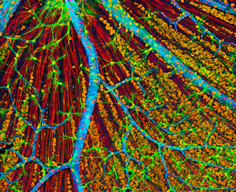 World-first: therapy to make cells young again trialled in a person World-first: therapy to make cells young again trialled in a person
