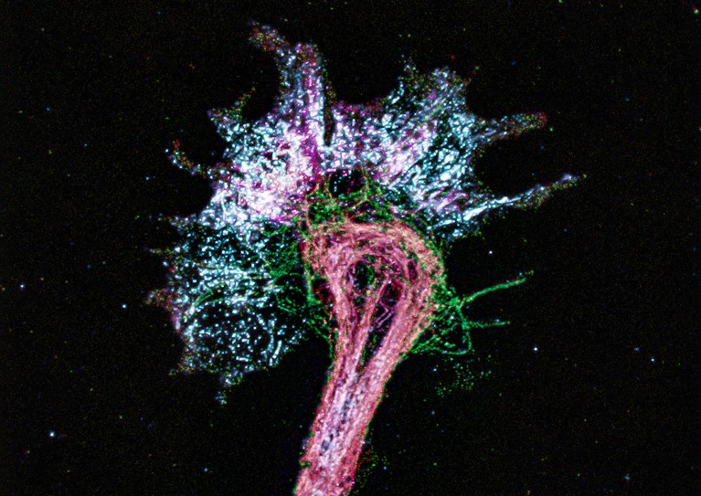 Light micrograph of a nerve cell that has been prepared with the expansion microscopy.