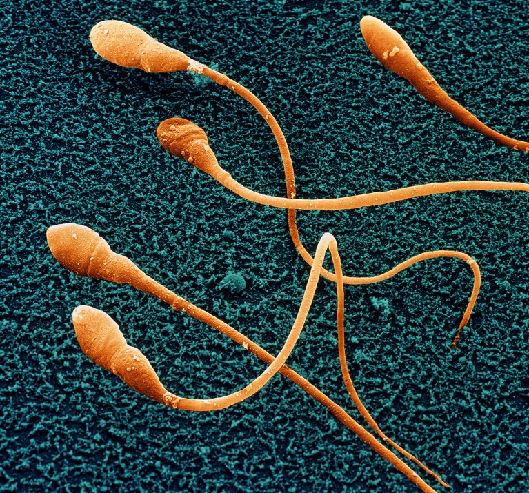 Coloured scanning electron micrograph of human sperm cells.
