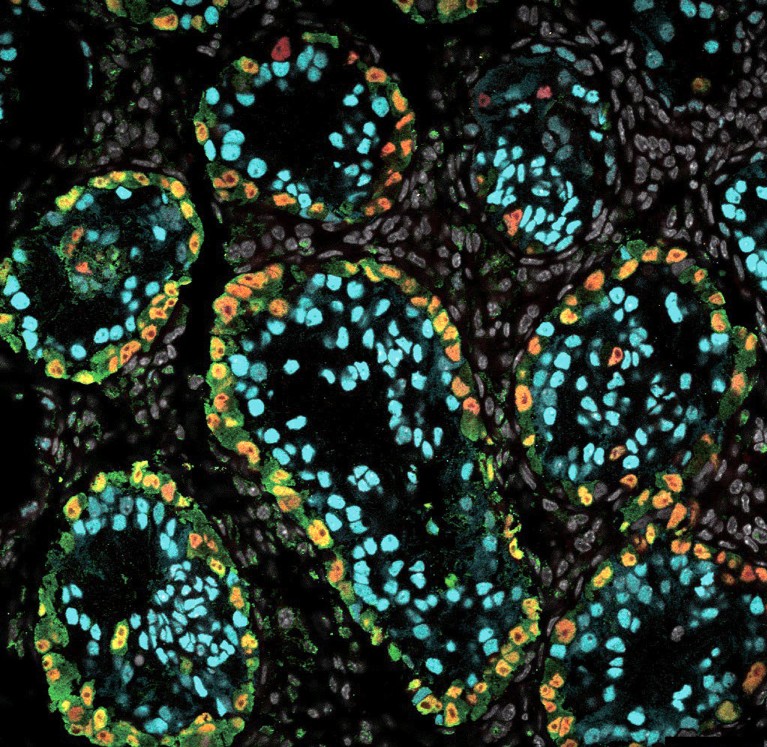 Imagem de microscopia de alta ampliação mostrando proteína verde fluorescente de xrTestis 1 mês após o transplante em um macaco rhesus.