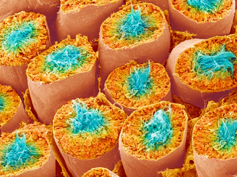 A coloured scanning electron micrograph of a transverse section across a repeating pattern of circular orange seminiferous tubules, containing blue-coloured human sperm