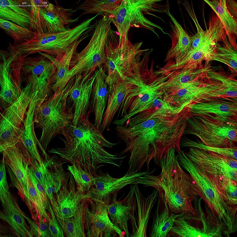 Fluorescent microscope image showing a network of fibroblasts