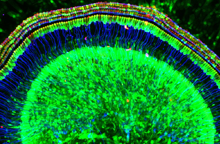 microscope image showing green cells at centre, surrounded by blue structures and then green.