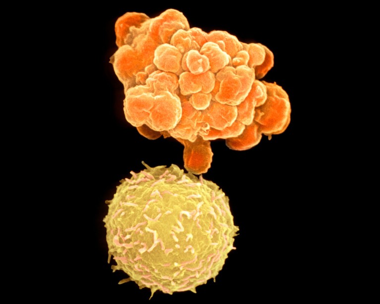 Scanning electron micrograph of two human white blood cells, including one undergoing apoptosis.