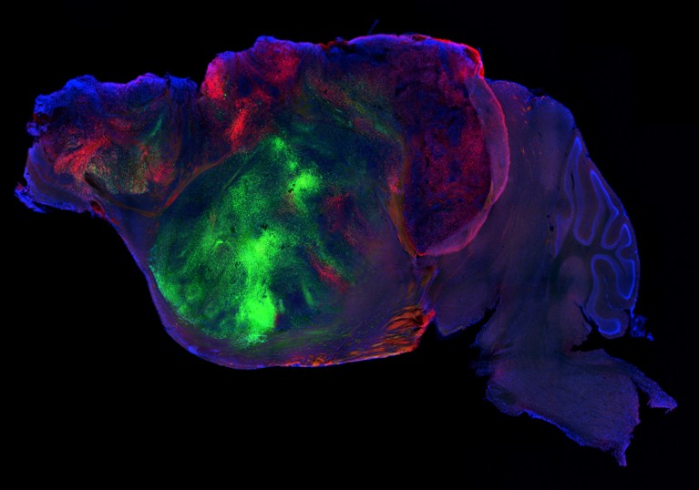 Lateral view of a mouse brain containing transplanted human brain tissue. Nerve fibres extend from the human graft through the mouse brain.