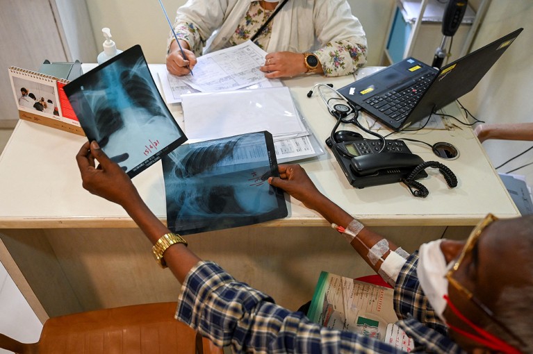A patient with tuberculosis holds two chest x-rays during a routine consultation with a doctor in India.