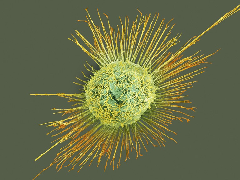 Scanning electron micrograph of H1N1 influenza (flu) virus particles budding from a lung cell.
