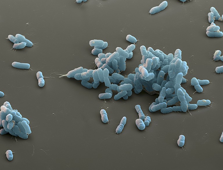 Coloured scanning electron micrograph (SEM) of plague bacteria (Yersinia pestis), resembling sticky grains of rice.