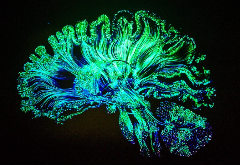 A representation of the human brain in green filaments on a black background.
